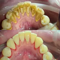 Higienizacja 1