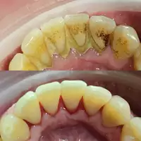Higienizacja 2