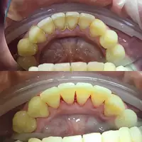 Higienizacja 4