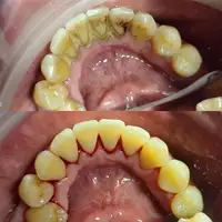 Higienizacja 3